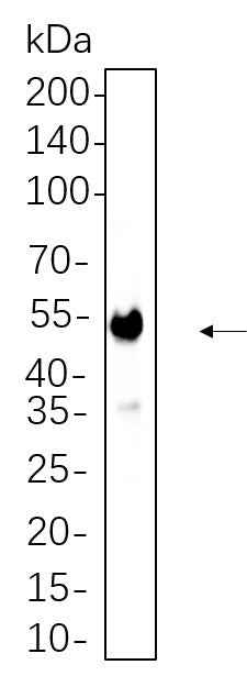 Anti-Human/Mouse/Rat CaMKII α Antibody [B780] - ABMIUM