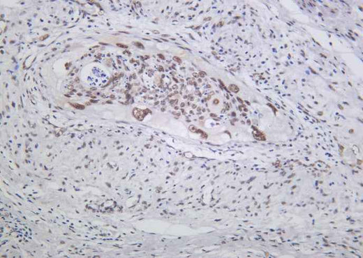 Anti-Human/Mouse/Rat MRE11 Antibody [B1031] - ABMIUM