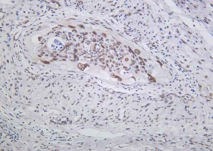 Anti-Human/Mouse/Rat MRE11 Antibody [B1031]