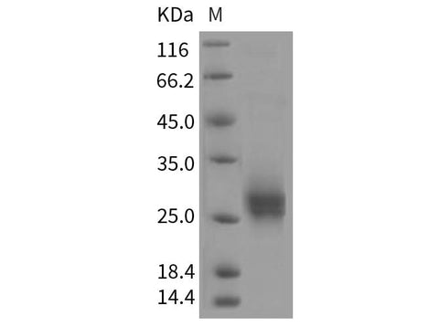 Recombinant Rat CD90/THY-1 Protein (His Tag) - ABMIUM