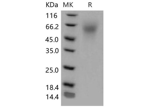 Recombinant Mouse LYPD3 Protein (His Tag) - ABMIUM