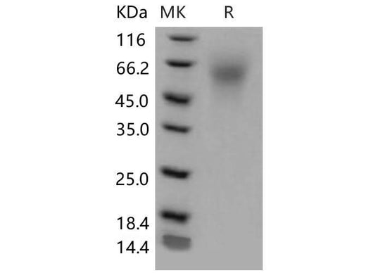 Recombinant Mouse LYPD3 Protein (His Tag) - ABMIUM