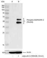 Anti-Human MAPKAPK2 Antibody [A1267] - ABMIUM