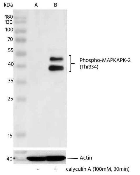 Anti-Human MAPKAPK2 Antibody [A1267] - ABMIUM
