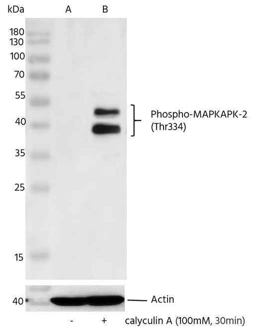 Anti-Human MAPKAPK2 Antibody [A1267] - ABMIUM