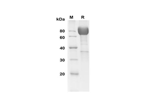 SDS-PAGE analysis of Rat IL-1 RI proteins, 2 μg/lane of Recombinant Rat IL-1 RI proteins was resolved with SDS-PAGE under reducing conditions, showing bands at 80 kDa.