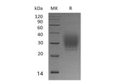 Recombinant Human PTH1R Protein (His Tag) - ABMIUM