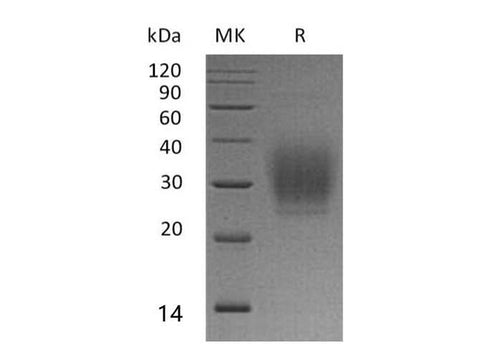 Recombinant Human PTH1R Protein (His Tag) - ABMIUM