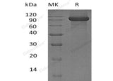 Recombinant Human KEL/CD238 Protein (His Tag) - ABMIUM