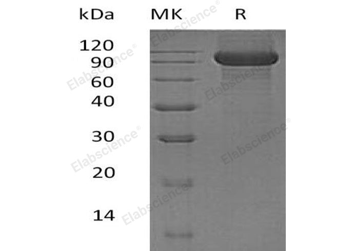 Recombinant Human KEL/CD238 Protein (His Tag) - ABMIUM