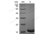 Recombinant Human Retinol-Binding Protein 1/RBP1 Protein - ABMIUM