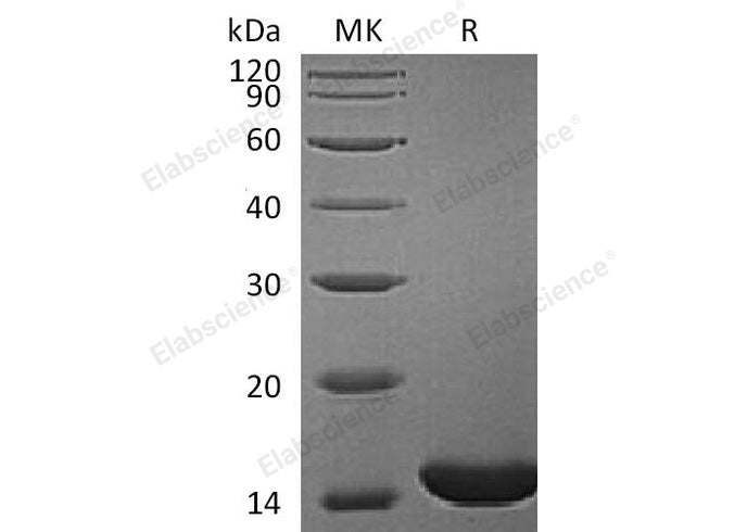 Recombinant Human Retinol-Binding Protein 1/RBP1 Protein - ABMIUM