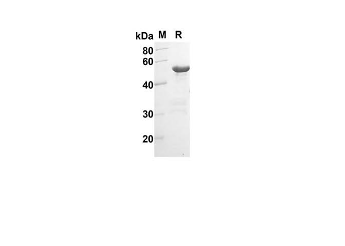 SDS-PAGE analysis of Human IVL proteins, 2 μg/lane of Recombinant Human IVL proteins was resolved with an SDS-PAGE under reducing conditions, showing bands at 40 kDa.