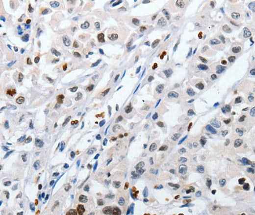 Anti-Human/Mouse/Rat HSPA1A Antibody