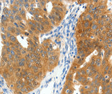 Anti-Human SCN9A Antibody - ABMIUM