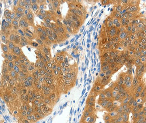Anti-Human SCN9A Antibody - ABMIUM