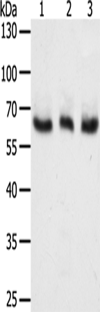 Anti-Human/Mouse TYR Antibody - ABMIUM
