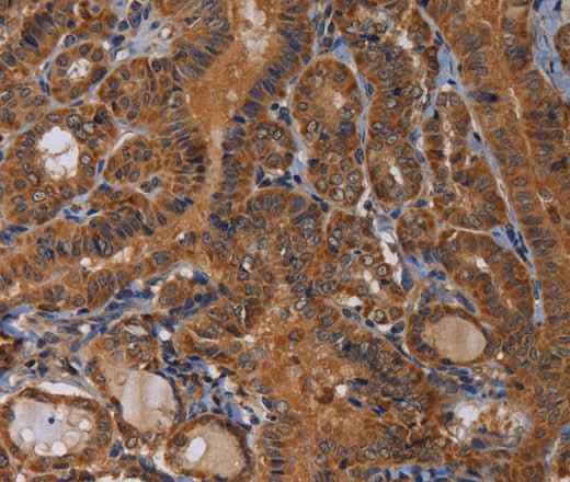 Anti-Human MAGEB10 Antibody