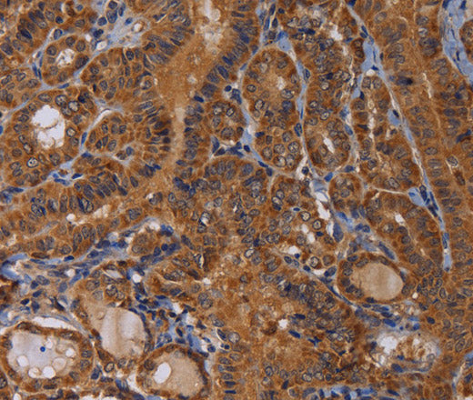 Anti-Human MAGEB10 Antibody - ABMIUM