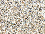 Anti-Human/Mouse/Rat NME2 Antibody - ABMIUM