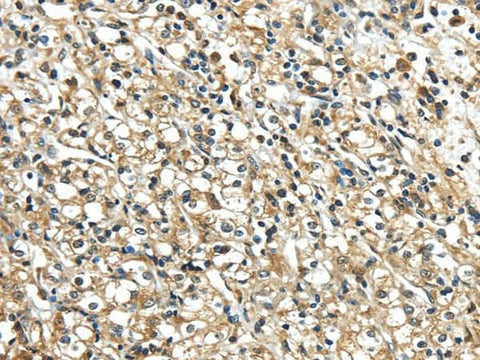 Anti-Human/Mouse/Rat NME2 Antibody - ABMIUM