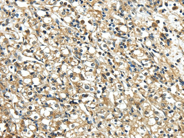 Anti-Human/Mouse/Rat NME2 Antibody - ABMIUM