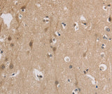 Anti-Human/Mouse ELOVL1 Antibody - ABMIUM