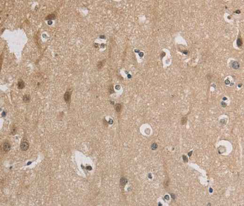Anti-Human/Mouse ELOVL1 Antibody