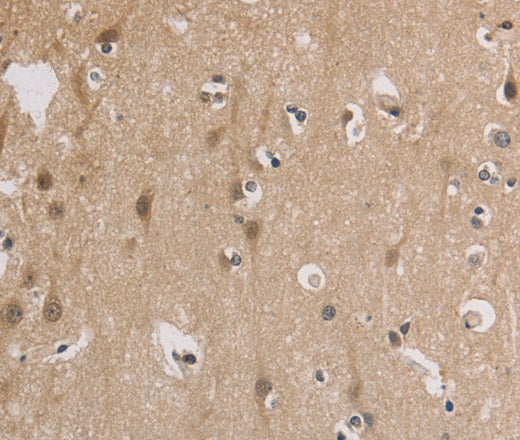 Anti-Human/Mouse ELOVL1 Antibody - ABMIUM