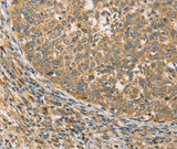 Anti-Human/Mouse/Rat ATG3 Antibody - ABMIUM