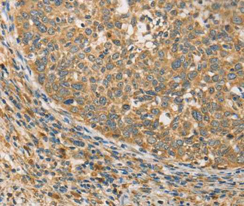Anti-Human/Mouse/Rat ATG3 Antibody
