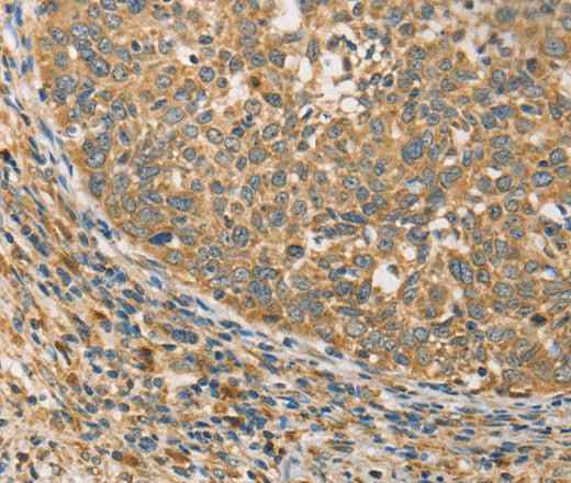 Anti-Human/Mouse/Rat ATG3 Antibody