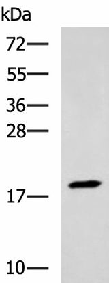 Western blot analysis of Human muscle tissue lysate using TNNC2 Polyclonal Antibody at dilution of 1:400