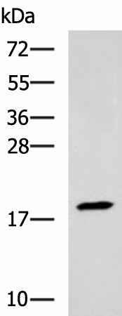 Western blot analysis of Human muscle tissue lysate using TNNC2 Polyclonal Antibody at dilution of 1:400