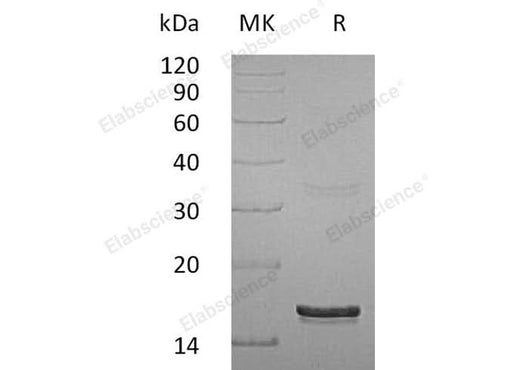 Recombinant Human Interferon γ/IFNG Protein - ABMIUM
