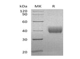 Recombinant Human Mesothelin/MSLN Protein (aa 296-598, His Tag) - ABMIUM