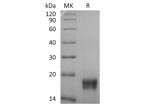 Recombinant Human GADD45β/GADD45B Protein (His Tag) - ABMIUM