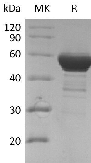 Recombinant SARS-CoV Nucleocapsid Protein - ABMIUM