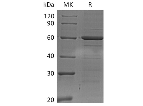 Recombinant Human IRF5 Protein (His Tag) - ABMIUM