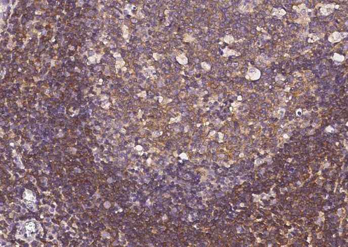 Anti-Human ERN1 Antibody [A1068] - ABMIUM