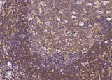 Anti-Human ERN1 Antibody [A1068] - ABMIUM