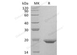 Recombinant Human Interleukin-17F/IL-17F Protein (His Tag) - ABMIUM