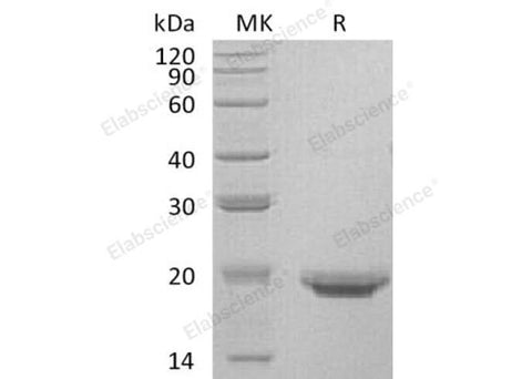Recombinant Human Interleukin-17F/IL-17F Protein (His Tag) - ABMIUM