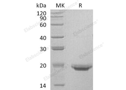Recombinant Human Interleukin-17F/IL-17F Protein (His Tag) - ABMIUM