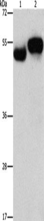 Anti-Human AMZ1 Antibody - ABMIUM