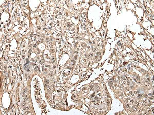 Anti-Human/Mouse/Rat UTP3 Antibody