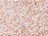 Anti-Human/Mouse/Rat CCL2 Antibody - ABMIUM
