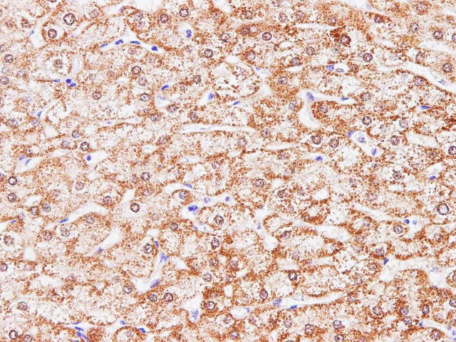 Anti-Human/Mouse/Rat CCL2 Antibody - ABMIUM