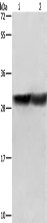 Anti-Human/Mouse/Rat CALB1 Antibody - ABMIUM