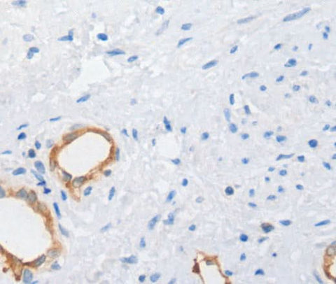 Anti-Human MUC5AC Antibody - ABMIUM